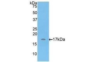 Detection of Recombinant ADAMTS7, Rat using Polyclonal Antibody to A Disintegrin And Metalloproteinase With Thrombospondin 7 (ADAMTS7) (ADAMTS7 anticorps  (AA 444-575))