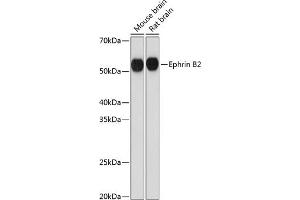 Western blot analysis of extracts of various cell lines, using Ephrin B2 Rabbit mAb (ABIN7266978) at 1:1000 dilution. (Ephrin B2 anticorps)