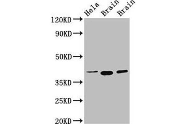 ERGIC2 anticorps  (AA 55-310)