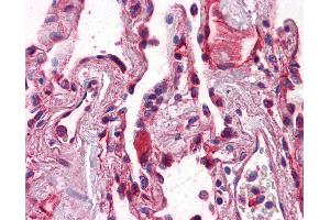 Anti-E Cadherin antibody IHC of human lung.