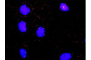 Proximity Ligation Analysis of protein-protein interactions between MAPK14 and MKNK2.