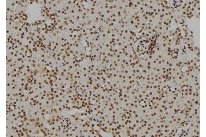 ABIN6269157 at 1/100 staining Rat kidney tissue by IHC-P. (GATA1 anticorps  (Internal Region))