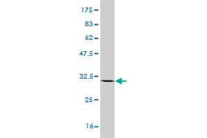 Western Blot detection against Immunogen (31.