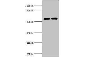 Western blot All lanes: CYP2E1 antibody at 12 μg/mL Lane 1: Jurkat whole cell lysate Lane 2: Mouse liver tissue Secondary Goat polyclonal to rabbit IgG at 1/10000 dilution Predicted band size: 57 kDa Observed band size: 57 kDa