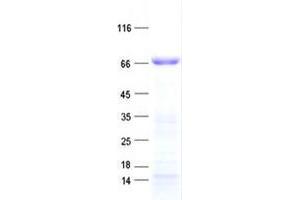 Validation with Western Blot