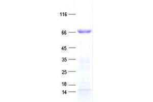 Validation with Western Blot (ZNF677 Protein (His tag))
