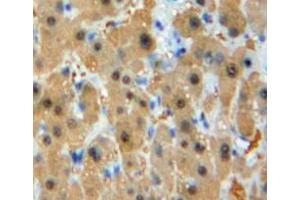 IHC-P analysis of liver tissuev, with DAB staining. (GSTM1 anticorps  (AA 1-218))