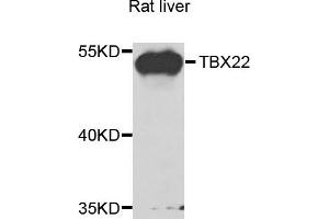 Western blot analysis of extracts of rat liver cells, using TBX22 antibody. (T-Box 22 anticorps)