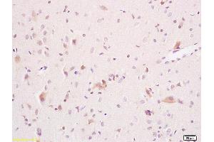 Formalin-fixed and paraffin embedded rat brain tissue labeled with Anti ARSA Polyclonal Antibody,Unconjugated (ABIN752428) at 1:200 followed by conjugation to the secondary antibody and DAB staining. (Arylsulfatase A anticorps  (AA 368-412))