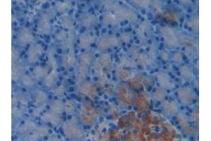 Detection of HSPBP1 in Rat Pancreas Tissue using Polyclonal Antibody to Heat Shock 70 kDa Binding Protein 1 (HSPBP1)