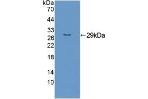 Detection of Recombinant RND1, Human using Polyclonal Antibody to Rho Family GTPase 1 (RND1) (RND1 anticorps  (AA 1-229))