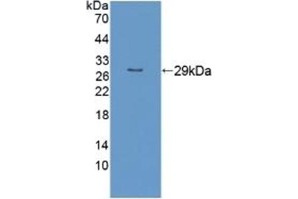 RND1 anticorps  (AA 1-229)
