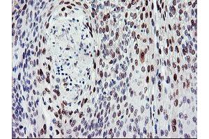 Immunohistochemistry (IHC) image for anti-BTB and CNC Homology 1, Basic Leucine Zipper Transcription Factor 1 (BACH1) antibody (ABIN1496803)