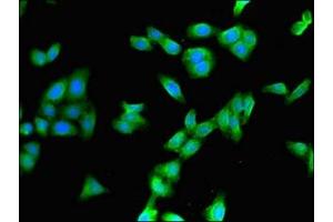 Immunofluorescent analysis of HepG2 cells using ABIN7149259 at dilution of 1:100 and Alexa Fluor 488-congugated AffiniPure Goat Anti-Rabbit IgG(H+L)
