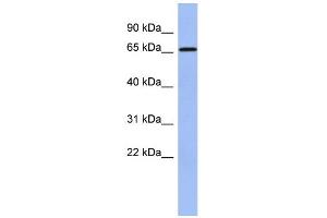WB Suggested Anti-A1CF Antibody Titration:  0. (A1CF anticorps  (N-Term))