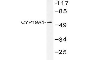 Western blot (WB) analysis of CYP19A1 Antibody in extracts from 293 cells. (Aromatase anticorps)