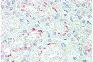 Human Kidney: Formalin-Fixed, Paraffin-Embedded (FFPE) (AQP3 anticorps  (AA 163-191))