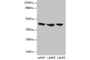 Western blot All lanes: IL2RG antibody at 12 μg/mL Lane 1: Jurkat whole cell lysate Lane 2: K562 whole cell lysate Lane 3: HL60 whole cell lysate Secondary Goat polyclonal to rabbit IgG at 1/10000 dilution Predicted band size: 43, 21 kDa Observed band size: 43 kDa (IL2RG anticorps  (AA 75-230))