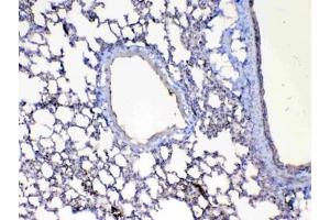 IHC testing of FFPE mouse lung tissue with Factor D antibody at 1ug/ml.