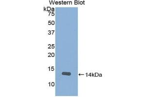 Western blot analysis of the recombinant protein. (SLIT2 anticorps  (AA 1408-1519))