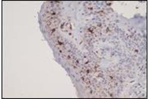 Immunohistochemistry (IHC) image for anti-CD1a (CD1a) (C-Term) antibody (ABIN870502) (CD1a anticorps  (C-Term))