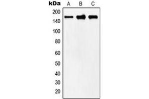 Western blot analysis of MYOM2 expression in human heart (A), mouse heart (B), rat heart (C) whole cell lysates. (MYOM2 anticorps  (Center))