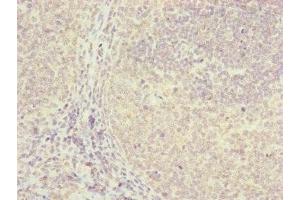 Immunohistochemistry of paraffin-embedded human tonsil tissue using ABIN7152411 at dilution of 1:100 (FBXO22 anticorps  (AA 104-403))