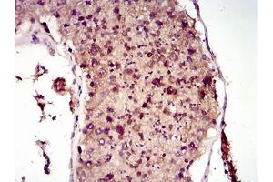 Immunohistochemical analysis of paraffin-embedded testis tissues using MAP1LC3A mouse mAb with DAB staining.