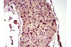 Immunohistochemical analysis of paraffin-embedded testis tissues using MAP1LC3A mouse mAb with DAB staining. (MAP1LC3A anticorps  (AA 1-121))
