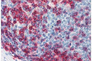 Immunohistochemistry staining of human spleen (paraffin sections) using anti-CD43 (MEM-59).