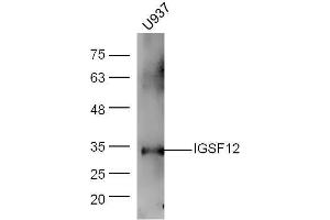 Human U937 lysates probed with Rabbit Anti-CD300A/C Polyclonal Antibody, Unconjugated  at 1:5000 for 90 min at 37˚C. (CD300A/ C (AA 20-70) anticorps)