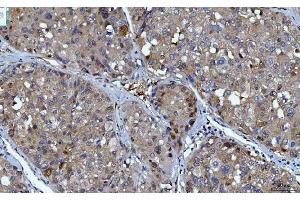 IHC analysis of YWHAE using anti-YWHAE antibody (ABIN7599165). (YWHAE anticorps  (AA 1-255))