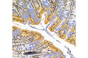 Immunohistochemistry of paraffin embedded mouse rectum using LTF (ABIN7074457) at dilution of 1: 700 (300x lens)