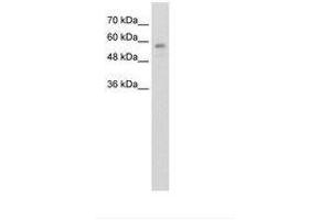 Image no. 1 for anti-RanBP-Type and C3HC4-Type Zinc Finger Containing 1 (RBCK1) (AA 181-230) antibody (ABIN203455) (RBCK1 anticorps  (AA 181-230))