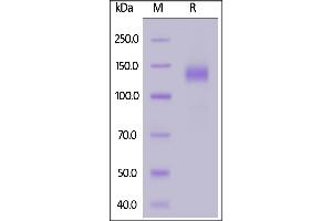 SARS-CoV-2 S1 protein, Fc Tag on  under reducing (R) condition. (SARS-CoV-2 Spike S1 Protein (P.1 - gamma) (Fc Tag))