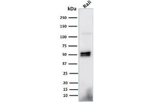 Western Blot Analysis of Raji cell lysate using CD79a Monoclonal Antibody (HM57). (CD79a anticorps  (AA 202-216))