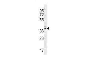 PGA4 Antibody (C-term) (ABIN656949 and ABIN2850496) western blot analysis in WiDr cell line lysates (35 μg/lane).