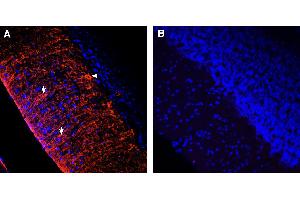 Comparison of immunostaining with Anti-KV1. (Lapin IgG isotype control (Atto 550))
