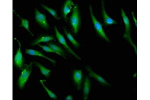 Immunofluorescence staining of Hela cells with ABIN7166420 at 1:66, counter-stained with DAPI. (PCMT1 anticorps  (AA 117-228))