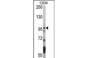 Western blot analysis of hHDAC7- (ABIN387957 and ABIN2844663) in CEM cell line lysates (35 μg/lane). (HDAC7 anticorps  (C-Term))