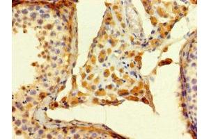 Immunohistochemistry of paraffin-embedded human testis tissue using ABIN7174650 at dilution of 1:100