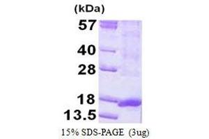 Oral Cancer Overexpressed 1 (ORAOV1) (AA 1-137) protein (His tag)