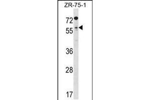 Western blot analysis in ZR-75-1 cell line lysates (35ug/lane). (TCFL5 anticorps  (C-Term))