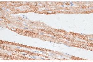 Immunohistochemistry of paraffin-embedded Rat heart using GRK5 Polyclonal Antibody at dilution of 1:100 (40x lens).