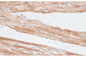 Immunohistochemistry of paraffin-embedded Rat heart using GRK5 Polyclonal Antibody at dilution of 1:100 (40x lens). (GRK5 anticorps)