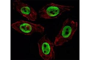 Fluorescent image of U251 cell stained with EZH2 antibody. (EZH2 anticorps)