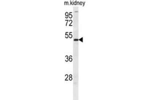 Western Blotting (WB) image for anti-Doublesex and Mab-3 Related Transcription Factor 3 (DMRT3) antibody (ABIN2995697)