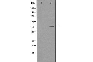 Western blot analysis of extracts from HeLa cells, using ME1 antibody. (ME1 anticorps  (C-Term))