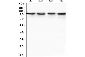 Western blot analysis of TRPV3 using anti-TRPV3 antibody (ABIN7601087).