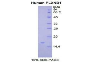 SDS-PAGE (SDS) image for Plexin B1 (PLXNB1) (AA 47-126) protein (His tag) (ABIN1080550) (PLXNB1 Protein (AA 47-126) (His tag))